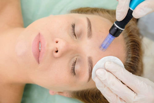 Micro-needling